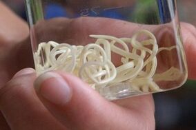 inson tanasidagi parazitlar